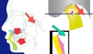 Functional analysis drawing with red arrows at Smilezone Dental Practice Zug.
