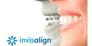 Invisalign logo comparing teeth with and without braces for a perfect smile.