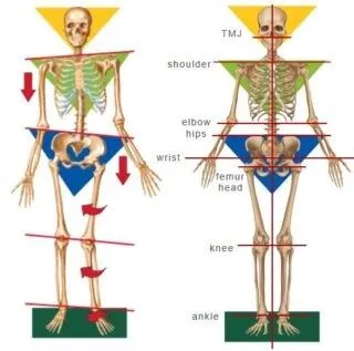 Illustration of body posture and jaw joint issues at Smilezone Dental Zug.