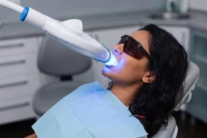 Power Bleaching Behandlung in der Zahnarztpraxis Smilezone in Zug